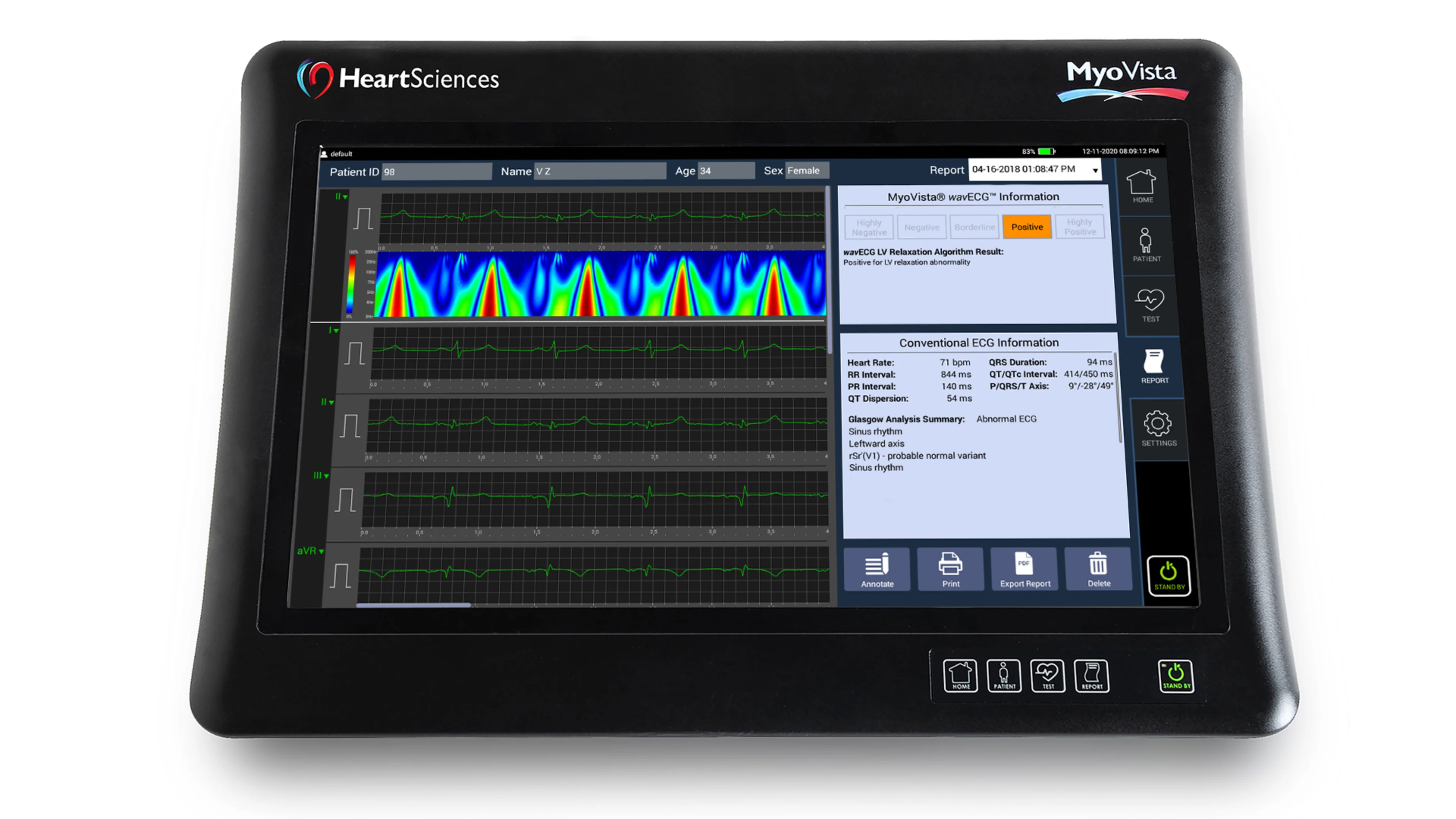 MyoVista wavECG Device
